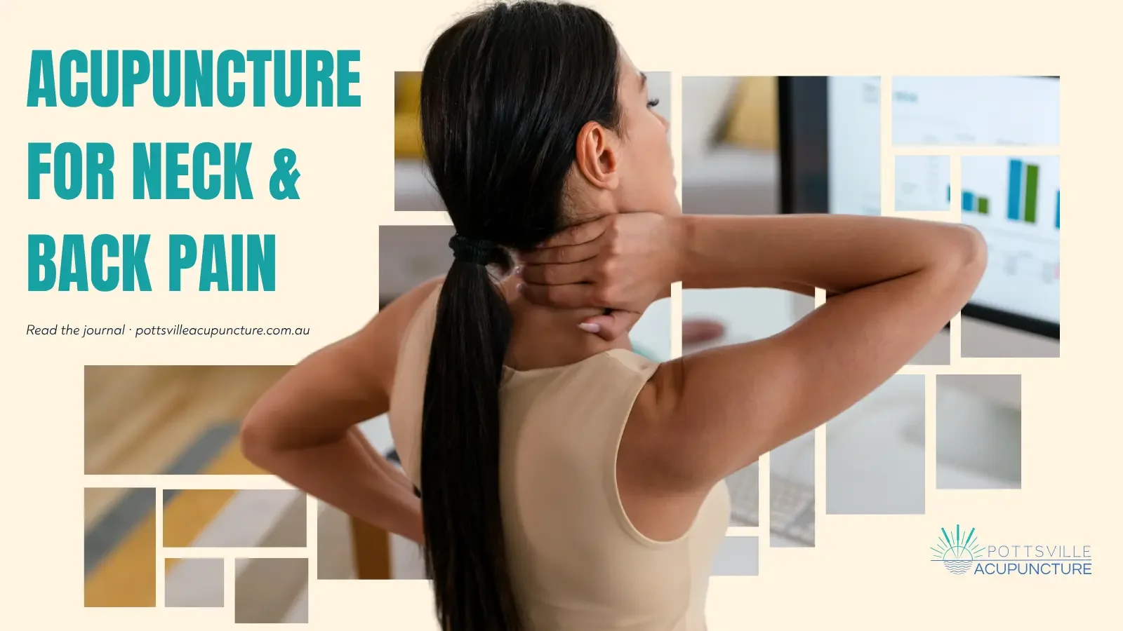 Acupuncture for Back and Neck Pain